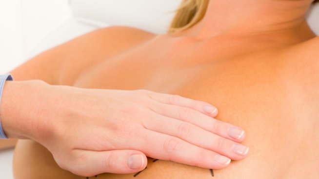 " Да" и "не" на козметичните пластични операции