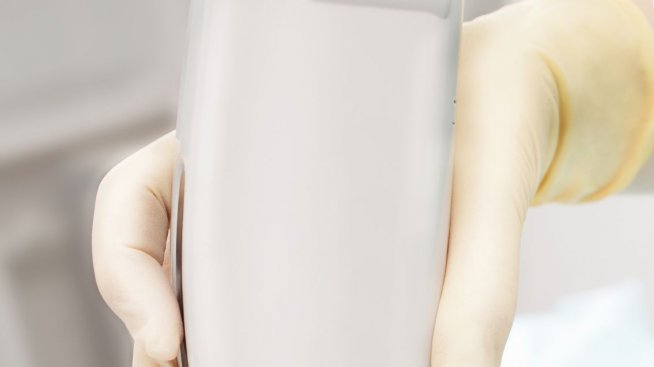 Лазерна епилация: Да или не? – Част 2