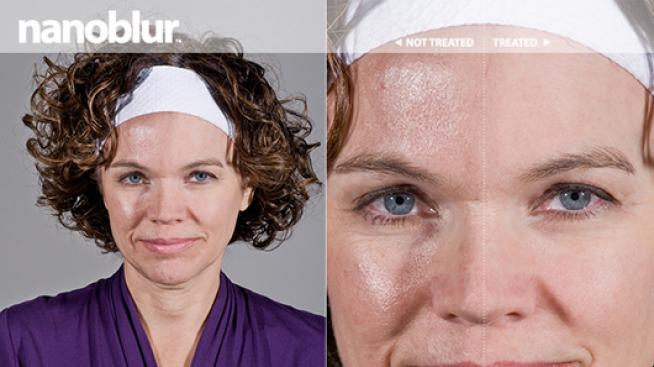 О, чудо! 10 години по-млада за 40 секунди