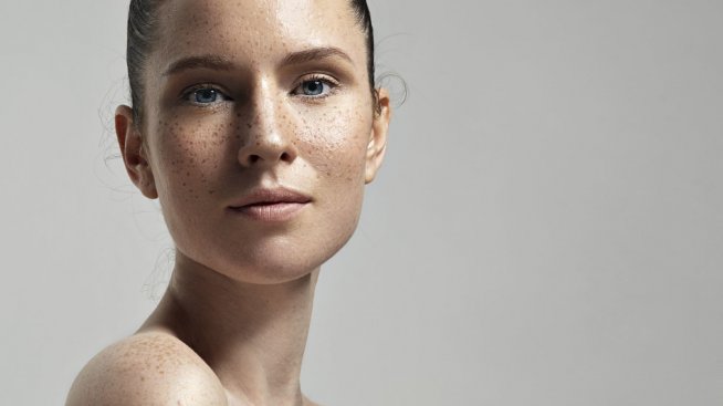 Как да премахнем пигментните петна?