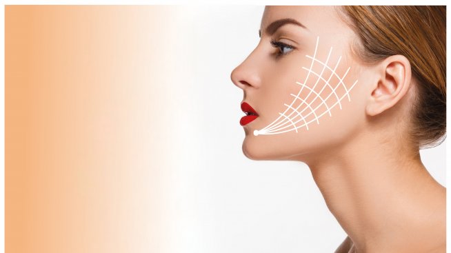 За по-младо лице: Радиочестотен лифтинг