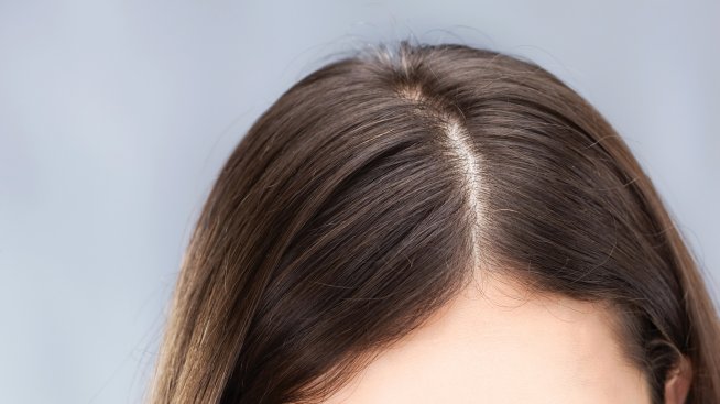 Най-честите рискове за хората, които носят контактни лещи