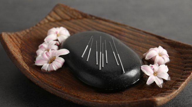 Козметична акупунктура: Какво представлява?