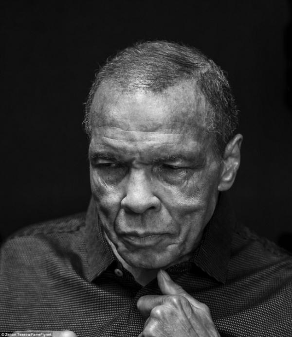 Най-трудната борба на Мохамед Али е 30-годишната битка с болест на Паркинсон. През юни 2016 г. той е приет в болница поради белодробни проблеми. На следващия ден лекарите съобщават, че е починал от септичен шок, който не е свързан с болестта му. Тогава той е на 74 години. Снимка: DailyMail