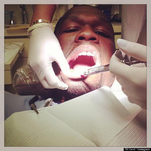 Рапърът 50 Cent ходи на зъболекар; Снимка: huffingtonpost.com