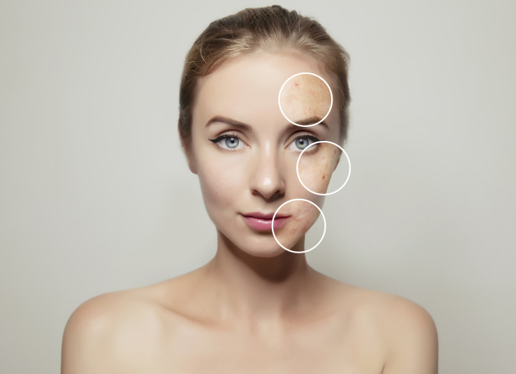 дерматит istock