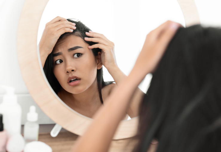 скалп istock
